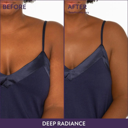 Body Coverage